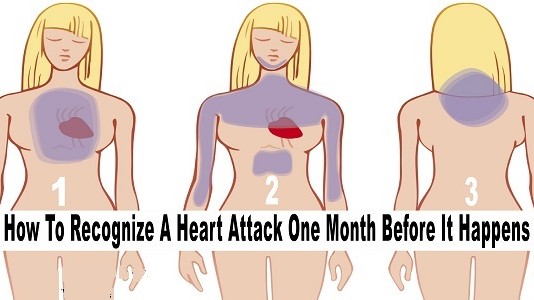 How To Recognize A Heart Attack One Month Before It Happens! | My Herbal Pleasures