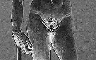 20160227233611