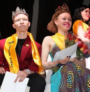 Mr. & Miss. Albinism Kenya, Jairus Ongeta (K.U) & Loice Lihenda. #BeautyBeyondtheSkin