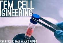 Wheelchair-bound Man Walks Again After Stem Cell Injections!